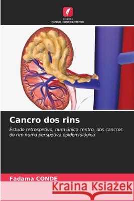 Cancro dos rins CONDE, Fadama 9786202003001