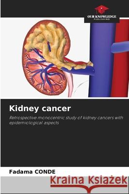 Kidney cancer CONDE, Fadama 9786202003018