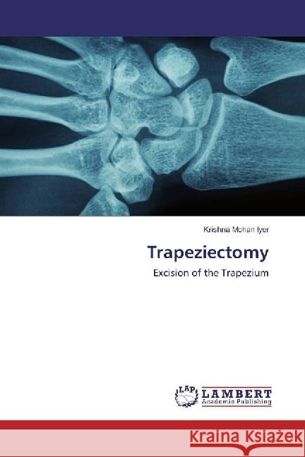 Trapeziectomy : Excision of the Trapezium Iyer, Krishna Mohan 9786202003087