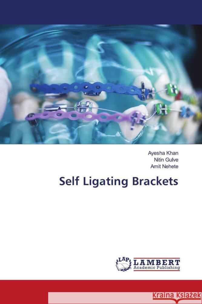 Self Ligating Brackets Khan, Ayesha, Gulve, Nitin, Nehete, Amit 9786202024532 LAP Lambert Academic Publishing