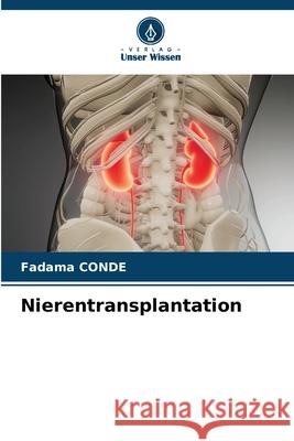 Nierentransplantation CONDE, Fadama 9786202029698