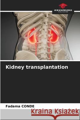 Kidney transplantation CONDE, Fadama 9786202029803
