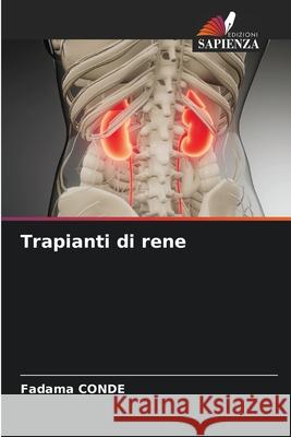 Trapianti di rene CONDE, Fadama 9786202030274
