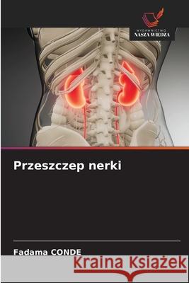 Przeszczep nerki CONDE, Fadama 9786202030571