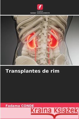 Transplantes de rim CONDE, Fadama 9786202031080
