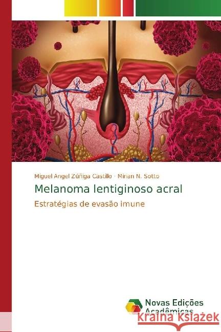 Melanoma lentiginoso acral : Estrate gias de evasa o imune Zúñiga Castillo, Miguel Angel; Sotto, Mirian N. 9786202032438