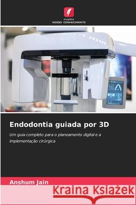 Endodontia guiada por 3D Anshum Jain 9786202041478 Edicoes Nosso Conhecimento