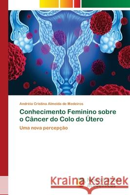 Conhecimento Feminino sobre o Câncer do Colo do Útero Almeida de Medeiros, Andréia Cristina 9786202047043