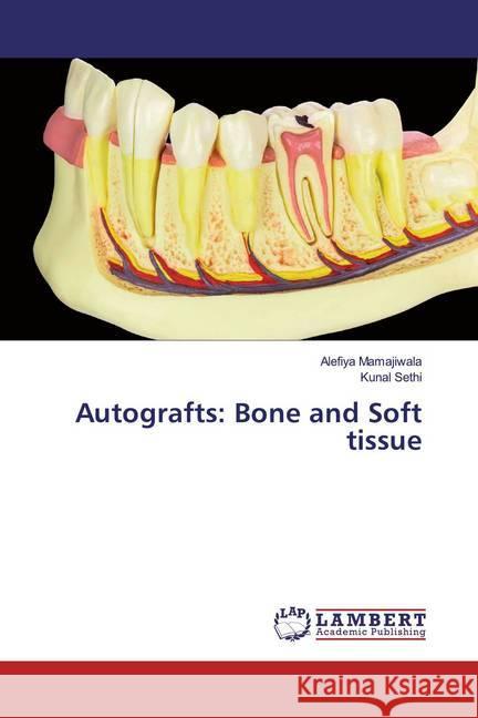 Autografts: Bone and Soft tissue Mamajiwala, Alefiya; Sethi, Kunal 9786202057677 LAP Lambert Academic Publishing