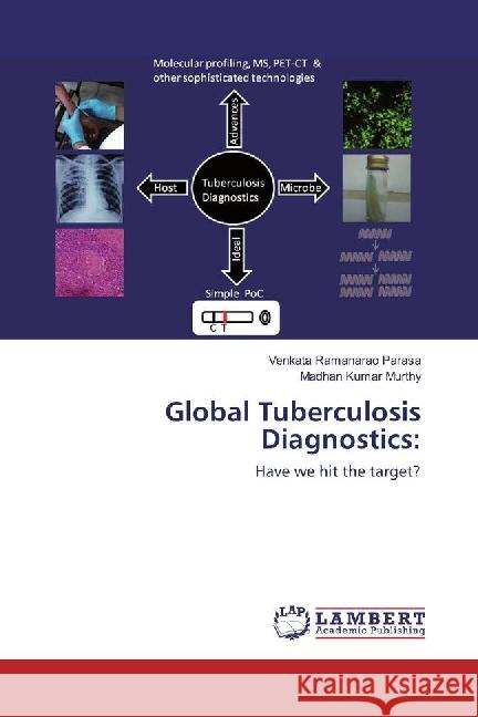 Global Tuberculosis Diagnostics: : Have we hit the target? Parasa, Venkata Ramanarao; Murthy, Madhan Kumar 9786202062923