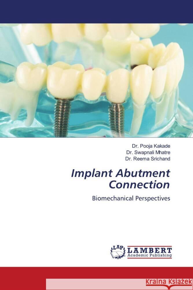 Implant Abutment Connection Kakade, Dr. Pooja, Mhatre, Dr. Swapnali, Srichand, Dr. Reema 9786202080071