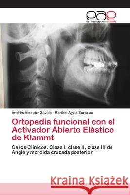 Ortopedia funcional con el Activador Abierto Elástico de Klammt Alcauter Zavala, Andrés 9786202100755