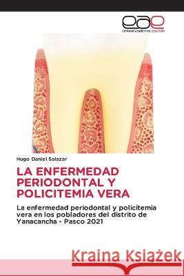 La Enfermedad Periodontal Y Policitemia Vera Hugo Daniel Salazar   9786202105248