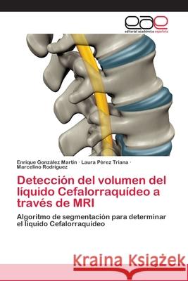 Detección del volumen del líquido Cefalorraquídeo a través de MRI González Martín, Enrique 9786202106146 Editorial Académica Española