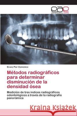 Métodos radiográficos para determinar disminución de la densidad ósea Pier Domenico, Bruno 9786202113878 Editorial Académica Española