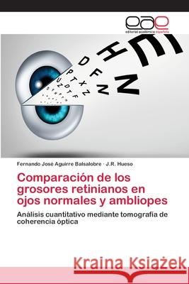 Comparación de los grosores retinianos en ojos normales y ambliopes Aguirre Balsalobre, Fernando José 9786202117685