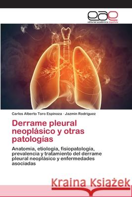 Derrame pleural neoplásico y otras patologías Toro Espinoza, Carlos Alberto 9786202119962 Editorial Académica Española