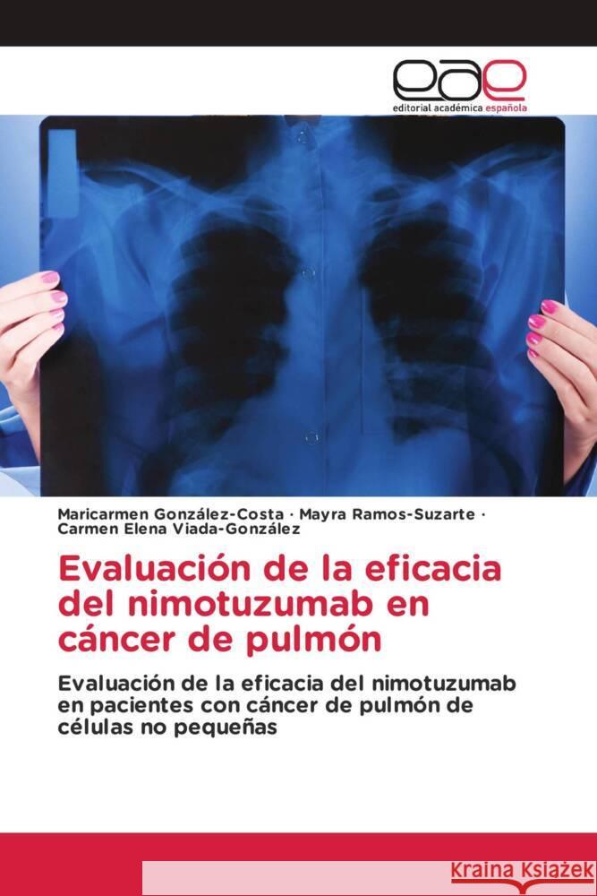 Evaluacion de la eficacia del nimotuzumab en cancer de pulmon Maricarmen Gonzalez-Costa Mayra Ramos-Suzarte Carmen Elena Viada-Gonzalez 9786202121699