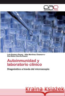 Autoinmunidad y laboratorio clínico Romero Reyes, Luis 9786202122863