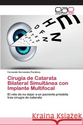 Cirugía de Catarata Bilateral Simultánea con Implante Multifocal Hernández Pardines, Fernando 9786202129374 Editorial Académica Española