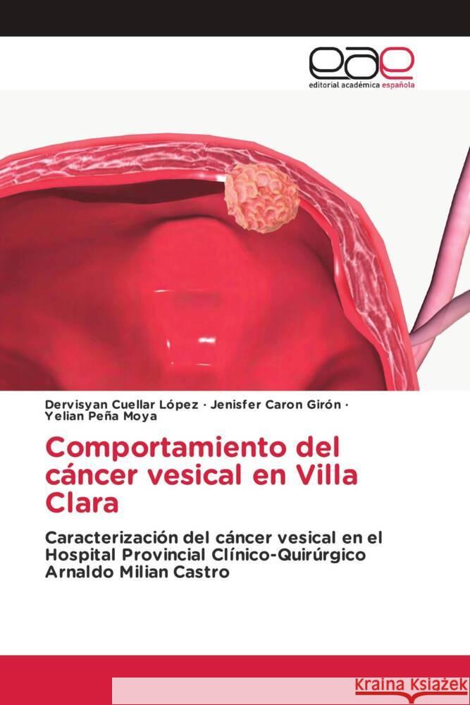 Comportamiento del cáncer vesical en Villa Clara Cuellar López, Dervisyan, Caron Girón, Jenisfer, Peña Moya, Yelian 9786202153867