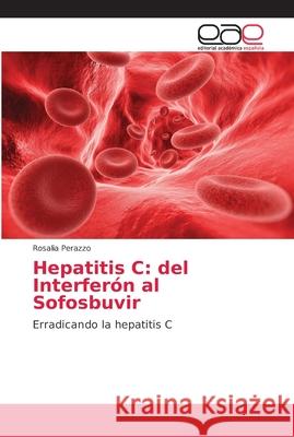 Hepatitis C: del Interferón al Sofosbuvir Perazzo, Rosalia 9786202163699
