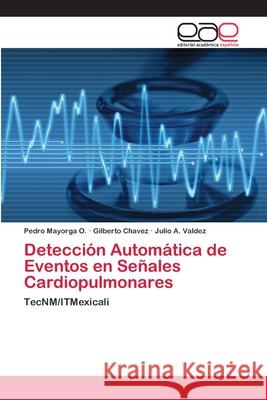 Detección Automática de Eventos en Señales Cardiopulmonares Mayorga O., Pedro 9786202170789 Novas Edicioes Academicas