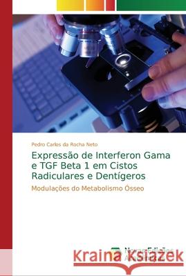 Expressão de Interferon Gama e TGF Beta 1 em Cistos Radiculares e Dentígeros Rocha Neto, Pedro Carlos Da 9786202178129