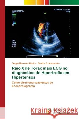 Raio X de Tórax mais ECG no diagnóstico de Hipertrofia em Hipertensos Marrone Ribeiro, Sergio 9786202181365 Novas Edicioes Academicas