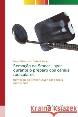 Remoção da Smear Layer durante o preparo dos canais radiculares Bittencourt, Bruna 9786202188982