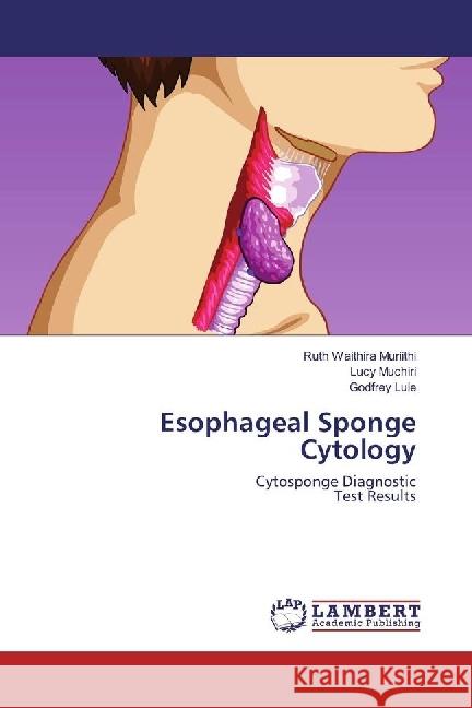 Esophageal Sponge Cytology : Cytosponge Diagnostic Test Results Waithira Muriithi, Ruth; Muchiri, Lucy; Lule, Godfrey 9786202197328