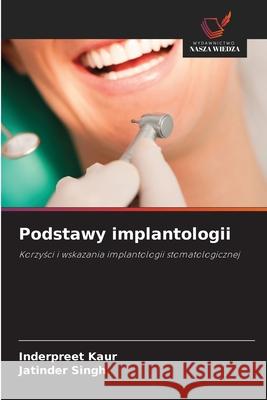 Podstawy implantologii Inderpreet Kaur Jatinder Singh 9786202209373