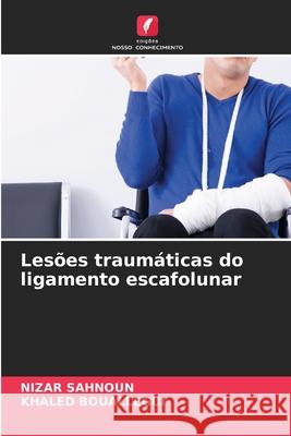 Lesões traumáticas do ligamento escafolunar Sahnoun, Nizar, BOUALLEGUI, KHALED 9786202214599