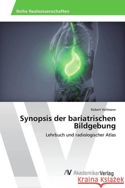 Synopsis der bariatrischen Bildgebung : Lehrbuch und radiologischer Atlas Vollmann, Robert 9786202222358 AV Akademikerverlag