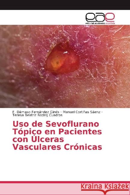 Uso de Sevoflurano Tópico en Pacientes con Úlceras Vasculares Crónicas Fernández Ginés, F. Dámaso; Cortiñas Sáenz, Manuel; Rodríg Cuadros, Teresa Beatriz 9786202230797