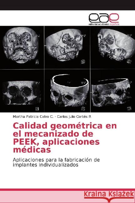 Calidad geométrica en el mecanizado de PEEK, aplicaciones médicas : Aplicaciones para la fabricación de implantes individualizados Calvo C., Martha Patricia; Cortés R, Carlos Julio 9786202231022