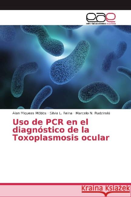 Uso de PCR en el diagnóstico de la Toxoplasmosis ocular Möbbs, Alan Miqueas; Reina, Silvia L.; Rudzinski, Marcelo N. 9786202243223