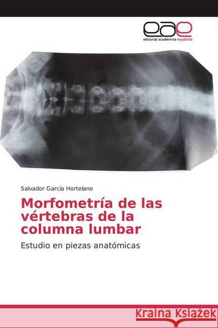 Morfometría de las vértebras de la columna lumbar : Estudio en piezas anatómicas García Hortelano, Salvador 9786202243476