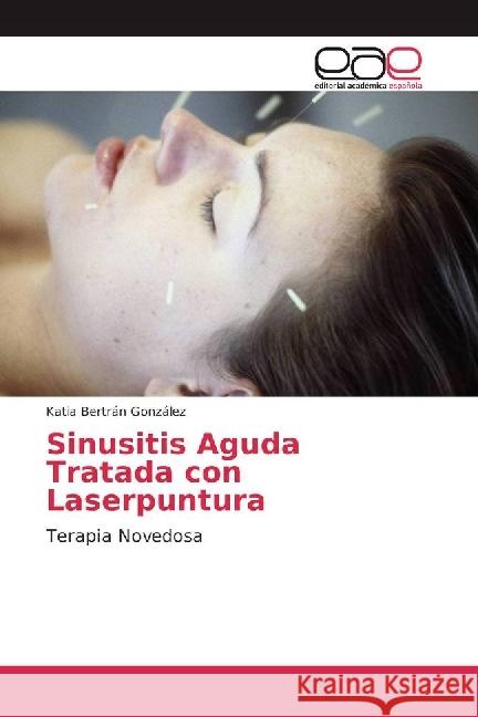 Sinusitis Aguda Tratada con Laserpuntura : Terapia Novedosa Bertrán González, Katia 9786202247412