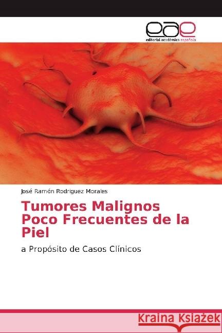 Tumores Malignos Poco Frecuentes de la Piel : a Propósito de Casos Clínicos Rodriguez Morales, José Ramón 9786202248976