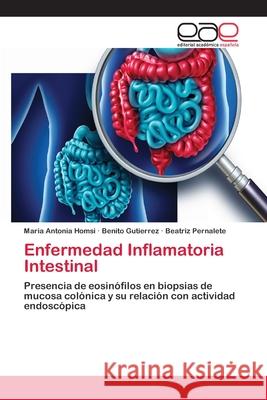 Enfermedad Inflamatoria Intestinal Homsi, Maria Antonia 9786202251259