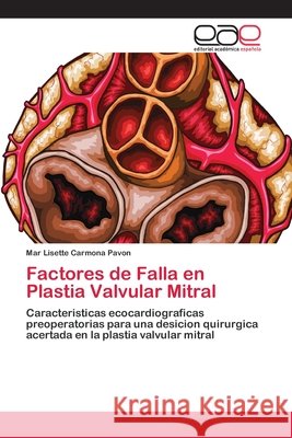 Factores de Falla en Plastia Valvular Mitral Carmona Pavon, Mar Lisette 9786202257985