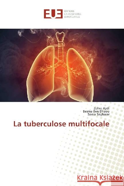 La tuberculose multifocale Aydi, Zohra; Ben Dhaou, Besma; Seghaier, Sonia 9786202261852