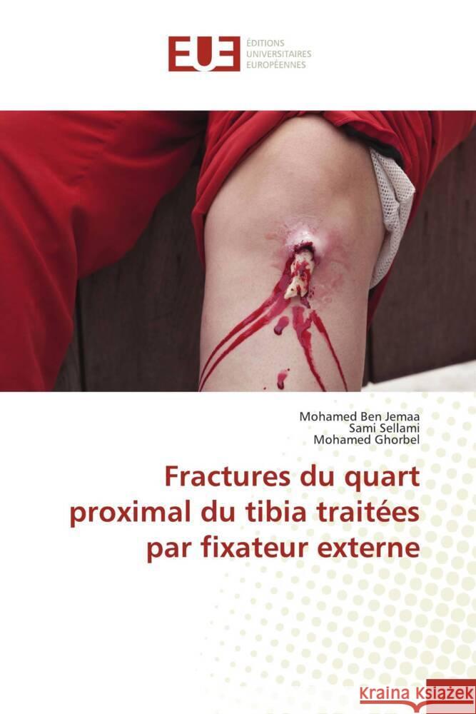 Fractures du quart proximal du tibia traitées par fixateur externe Ben Jemaa, Mohamed, Sellami, Sami, Ghorbel, Mohamed 9786202265751