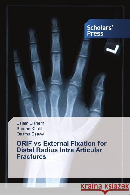 ORIF vs External Fixation for Distal Radius Intra Articular Fractures Elsherif, Eslam; Khalil, Shreen; Esawy, Osama 9786202305907