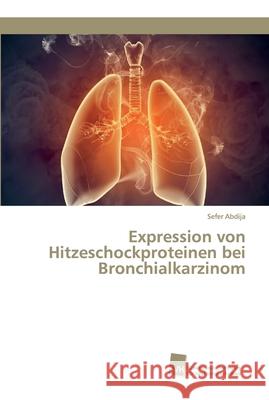 Expression von Hitzeschockproteinen bei Bronchialkarzinom Abdija, Sefer 9786202320443 Südwestdeutscher Verlag für Hochschulschrifte