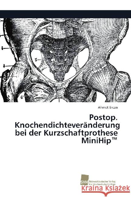 Postop. Knochendichteveränderung bei der Kurzschaftprothese MiniHip(TM) Ercan, Ahmet 9786202320603