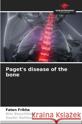 Paget's disease of the bone Frikha, Faten, Bouchhima, Rim, Bahloul, Zouhir 9786202325431 Our Knowledge Publishing