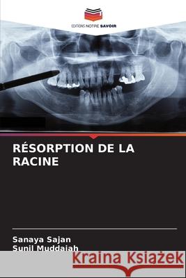 RÉSORPTION DE LA RACINE Sajan, Sanaya, Muddaiah, Sunil 9786202329439 Editions Notre Savoir