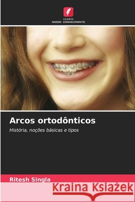 Arcos ortodônticos Singla, Ritesh 9786202333382